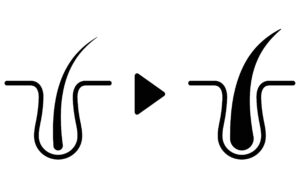 【最新】全米が注目の「KeraViatin」上陸か。臨床試験で実証された"髪の密度"を爆上げする科学的アプローチ